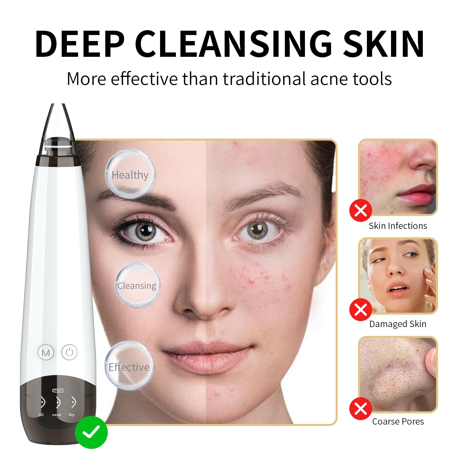 Blackhead Remover Pore Vacuum Cleaner - 6 Probes & 3 Adjustable Suction Levels, USB Rechargeable Blackhead Extractor Kit for Acne Prone Skin, Electric Facial Pore Cleaner for Adults (Off White) - Perfect for Home Spa & Skincare Routine