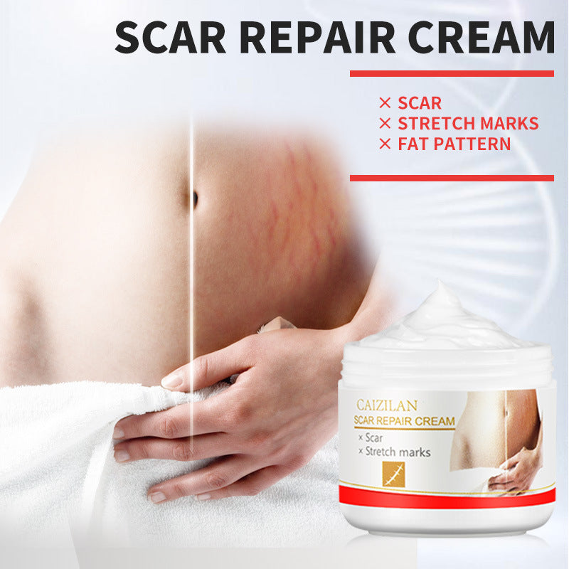 Best Acne Scar Repair Cream for Pregnant Women - 30g Skin Care Treatment for Face & Body - Safe for Sensitive Skin During Pregnancy & Postpartum