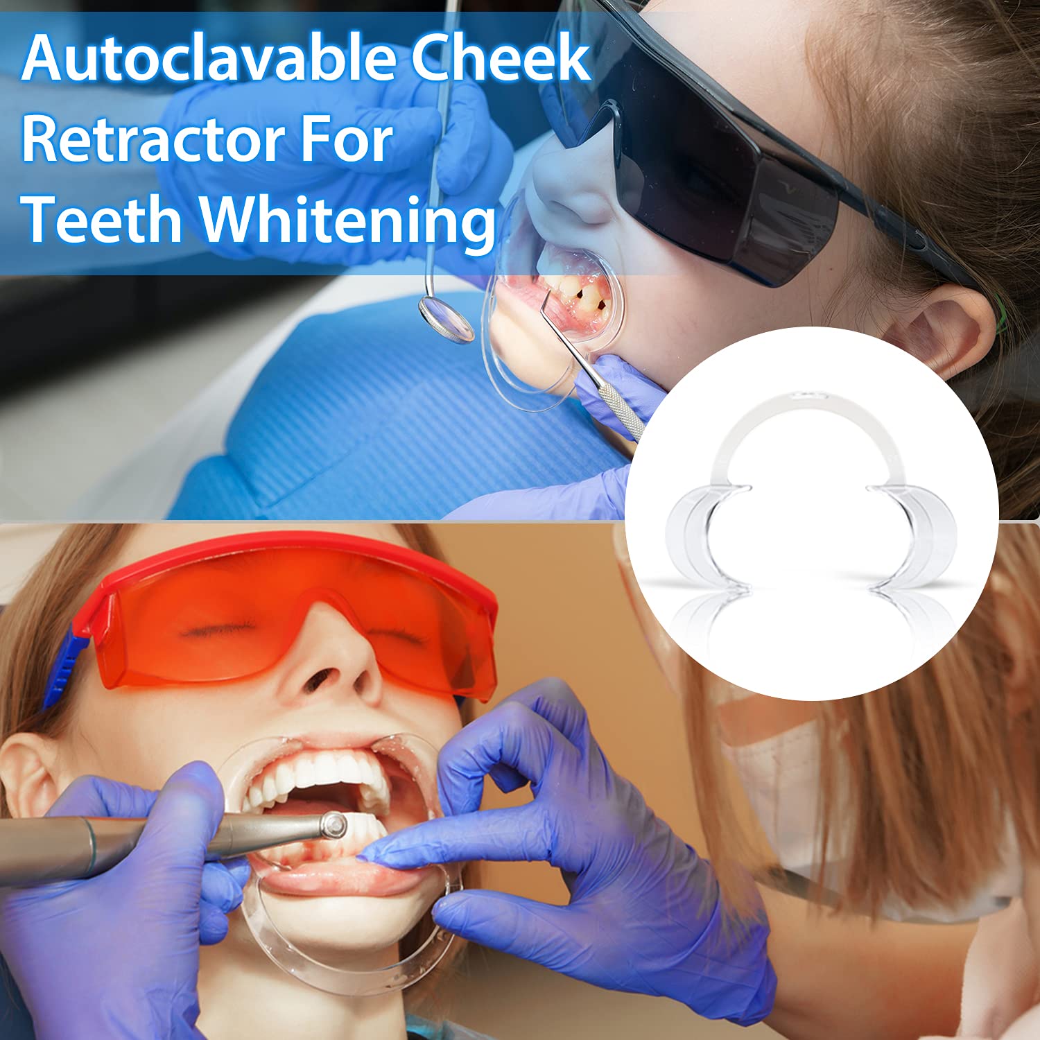 EZGO 20-Pack Disposable C-Shape Teeth Whitening Cheek Retractors - Dental Mouth Opener for Teeth Whitening, Dental Exams & Mouthguard Challenge Games (Size M) - Perfect for Dentists, Hygienists & At-Home Teeth Care