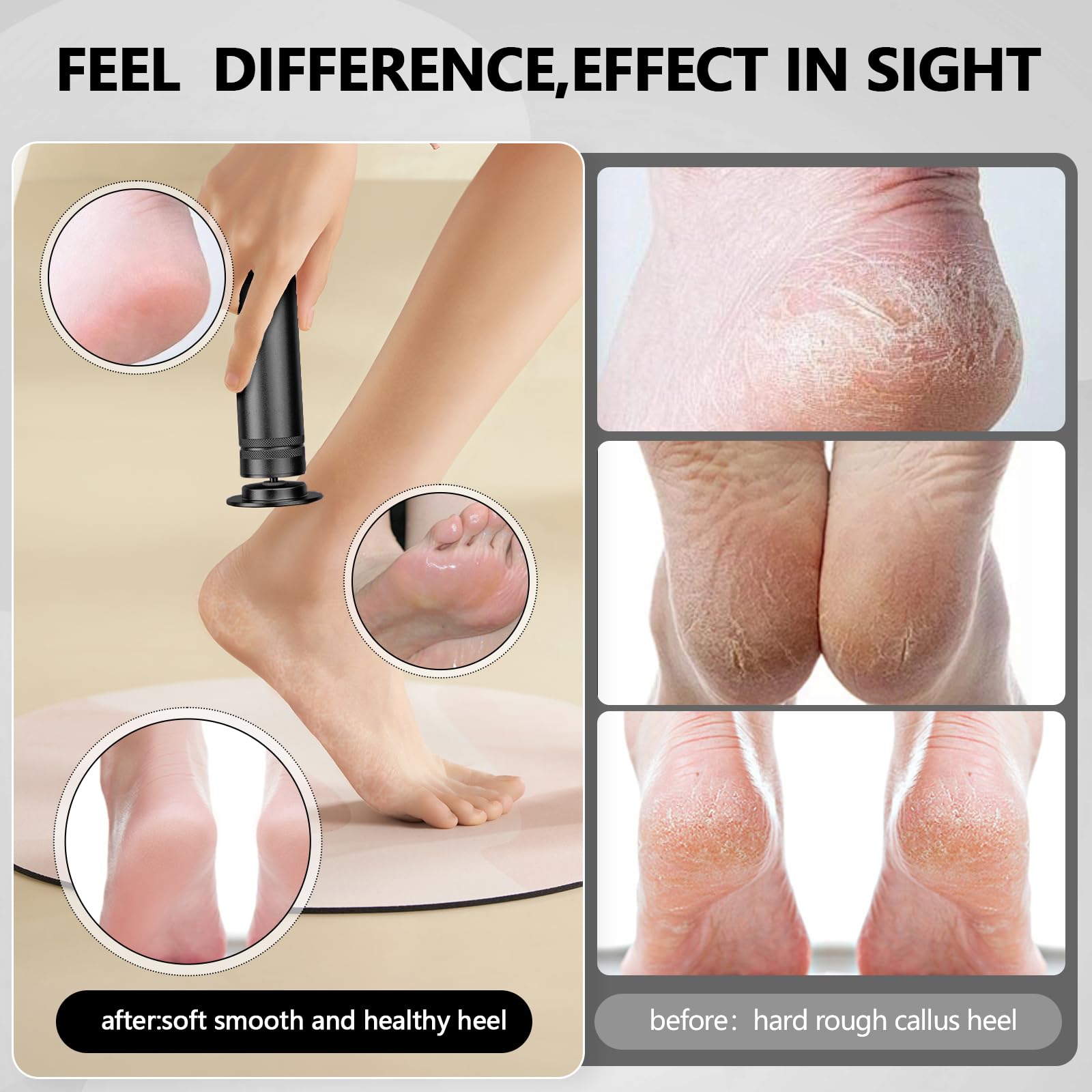 Professional Electric Foot Callus Remover - 1200 RPM Adjustable Speed Metal Foot Grinder for Dead Skin & Cracked Heels | Automatic Heel Sander with 10 Replacement Sandpaper Discs | Pedicure Tool for Women & Men | Perfect for Home Spa, Salon & DIY Foot Care (Black)
