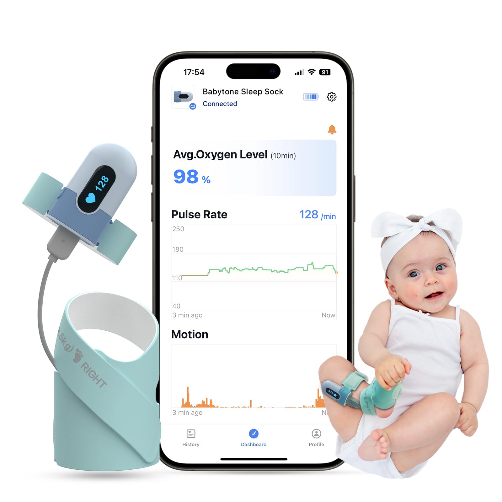 Babytone Baby Oxygen Monitor Sock - Track O2, Pulse & Movement for Infants 0-36M - Sleep Monitoring Wearable with Bluetooth App