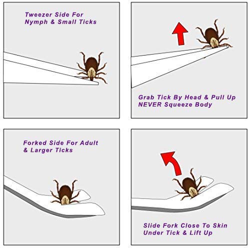 eTradewinds Tick Remover Tool Set - 2 Pack Stainless Steel Tick Removal Device with Leather Case | Safe & Hygienic Pet Tick Tweezers for Dogs, Cats | Perfect for Hiking, Camping & Outdoor Adventures