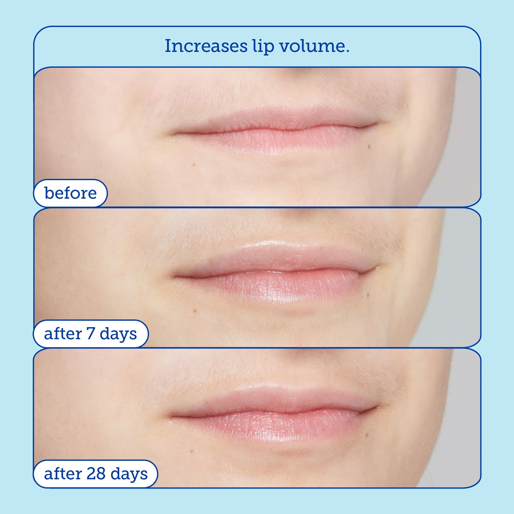 Barrier+ Triple Lipid Lip Treatment - Hydrating & Repairing Lip Balm for Dry, Chapped Lips | Day & Night Moisturizing Lip Care for All Seasons