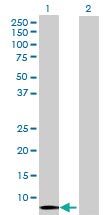 Anti-HCP5 Mouse Polyclonal Antibody (50µl) - High-Quality Research Antibody for Western Blot, ELISA, and Immunohistochemistry - Ideal for Laboratory Research and Biomedical Studies