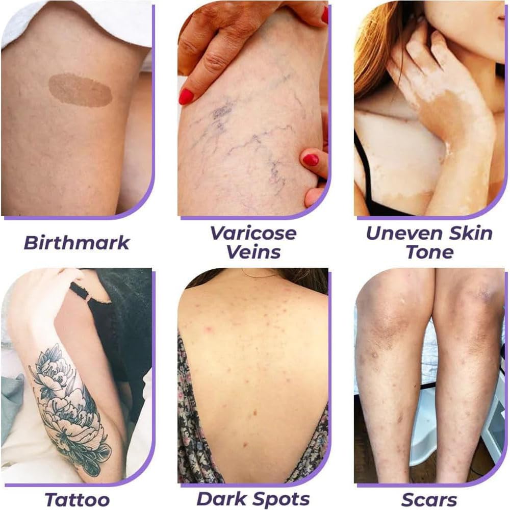 Full Coverage Body Concealer Lotion - Tattoo Cover Up, Scar Concealer, Long Lasting & Waterproof Foundation (1pc) for Flawless Skin at Weddings, Photos & Everyday Wear