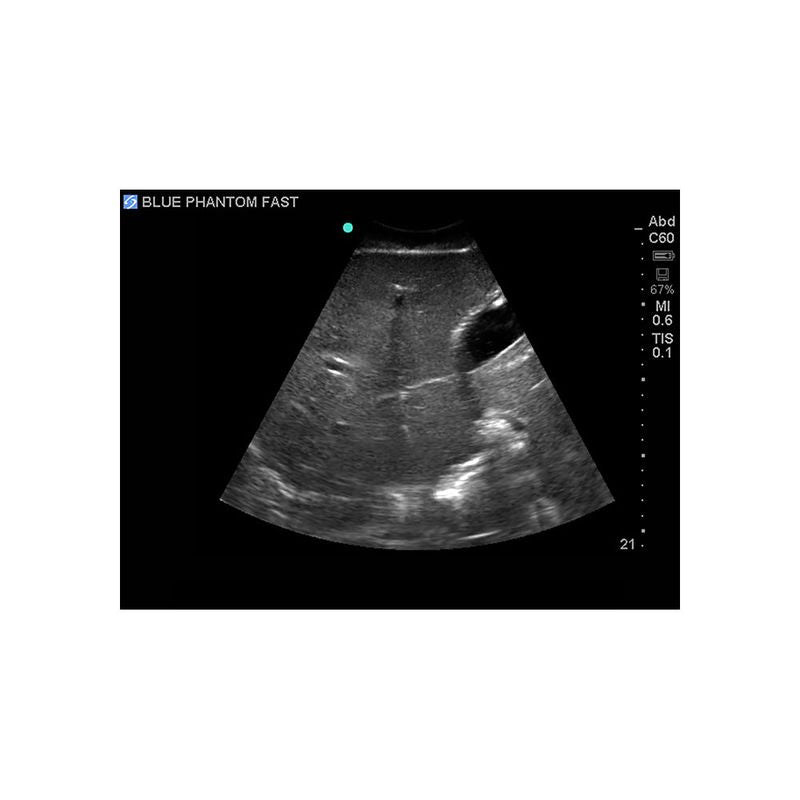 FAST Exam Ultrasound Training Model - Transthoracic & Transesophageal Echo Simulator for Cardiac Sonography Practice (Ideal for Medical Students, Ultrasound Tech Training & Clinical Skills Development)
