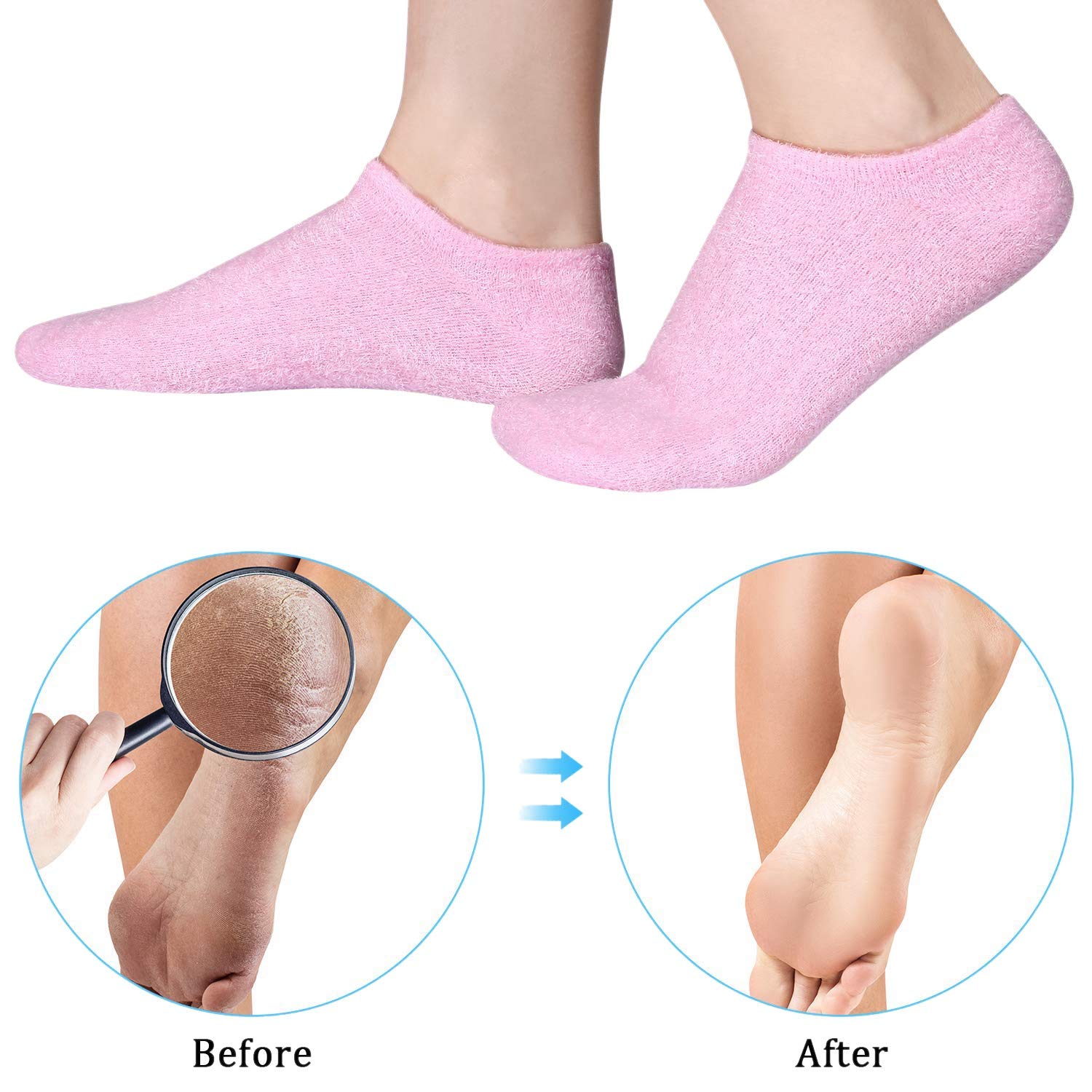 Ntcpefy Moisturizing Socks & Gloves Set - Hydrating Hand & Foot Care for Dry, Hard, Cracked Skin - Whitening Beauty Treatment for Soft Smooth Heels | Perfect for Overnight Spa, Winter Care & Cracked Heel Repair