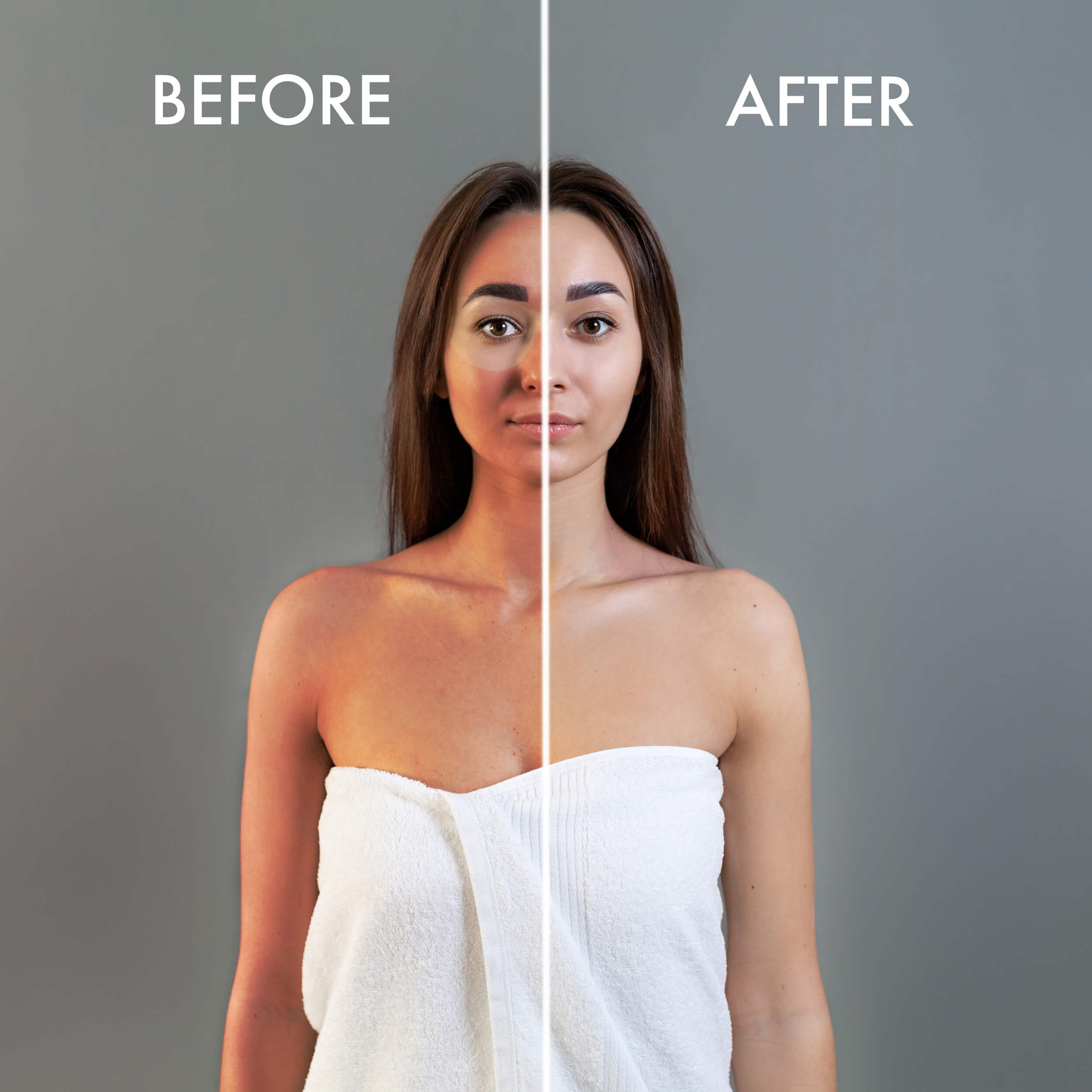 LUMI400II Professional Medical & Clinical Wall Mounted Photography Studio Flash Kit - Perfect for Before & After Shots | Ideal for Dermatology, Cosmetic Surgery, and Medical Documentation