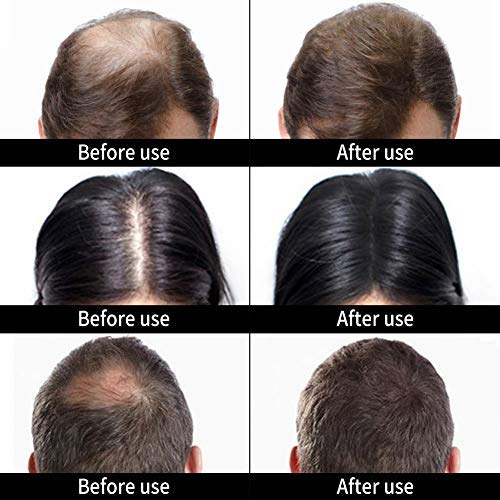Rayon Hair Building Fiber Refill Pack for Caboki & Toppik Bottles - 25g Black | Instant Hair Thickening Solution for Thinning Hair & Bald Spots | Perfect for Daily Use & Special Occasions