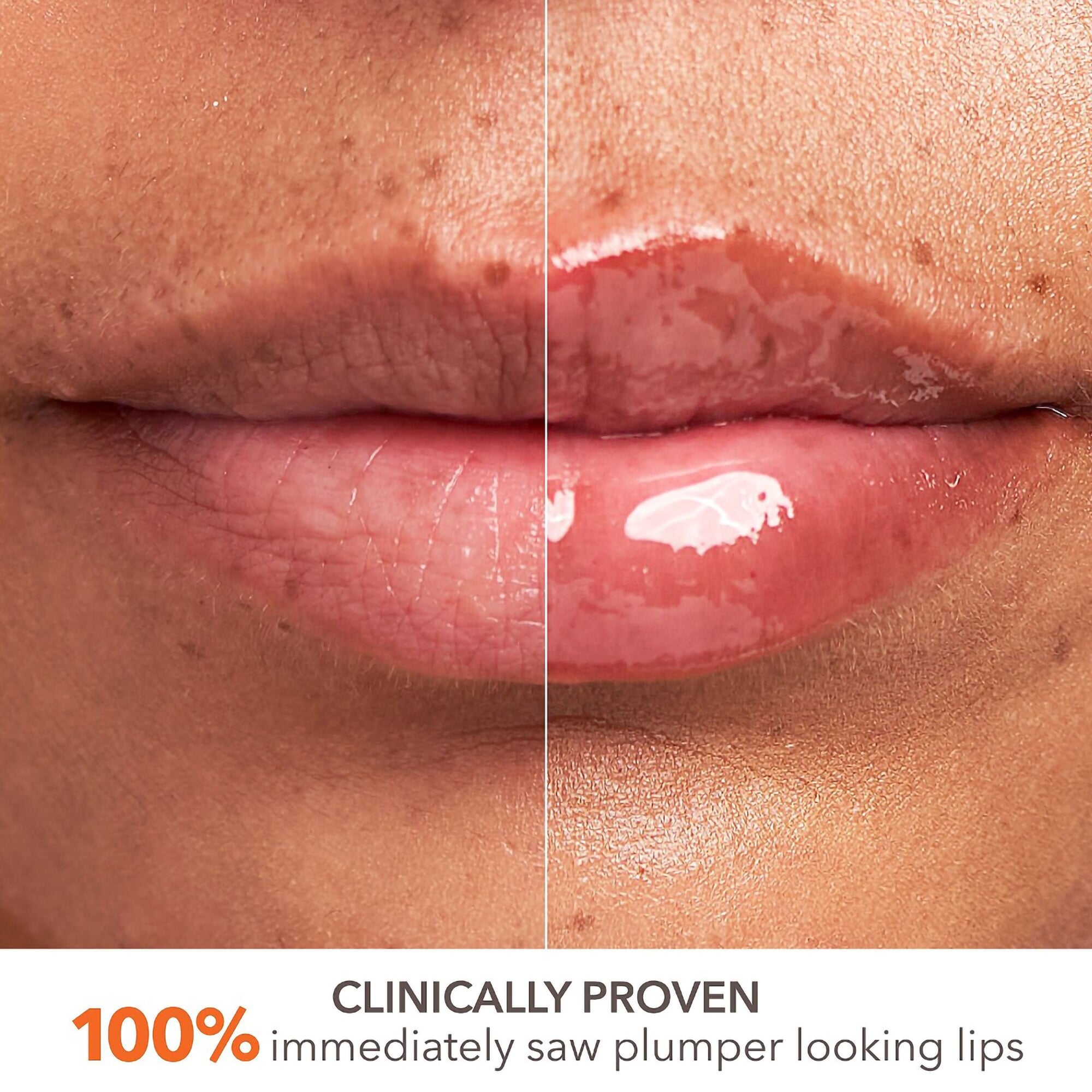 Dr. Dennis Gross DermInfusions Plump + Repair Lip Treatment - Hydrating Lip Balm for Dry, Chapped Lips | Perfect for Daily Moisturizing & Night Care