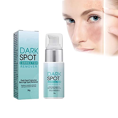 2022 Best Dark Spot Remover Cream for Face - Musely Fast-Acting Black Spot Treatment, Hyperpigmentation & Age Spot Corrector - Brightens Skin & Evens Tone - Perfect for Daily Skincare & Post-Acne Marks (1pc)