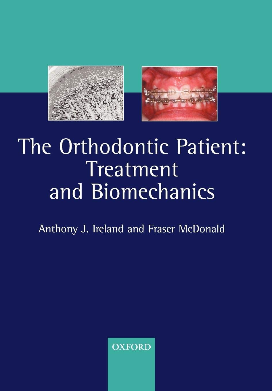 Orthodontic Treatment & Biomechanics Guide for Patients - Best Practices for Braces & Aligners | Ideal for Dentists, Orthodontists & Dental Students