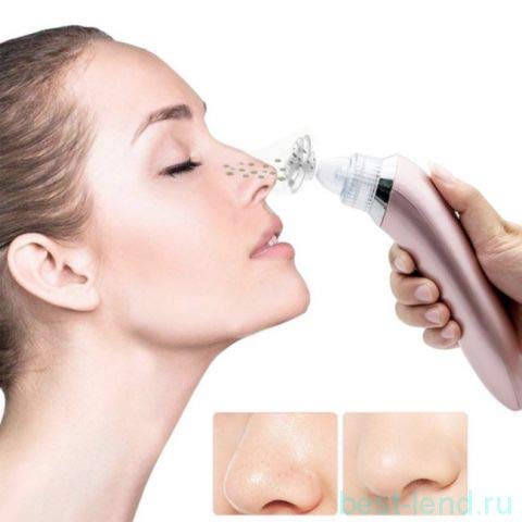 MOHAK Blackhead Remover Vacuum - Electric Pore Cleaner for Face & Nose, Whitehead & Blackhead Extractor Tool for Men & Women - Perfect for Daily Skincare & Spa Treatments at Home
