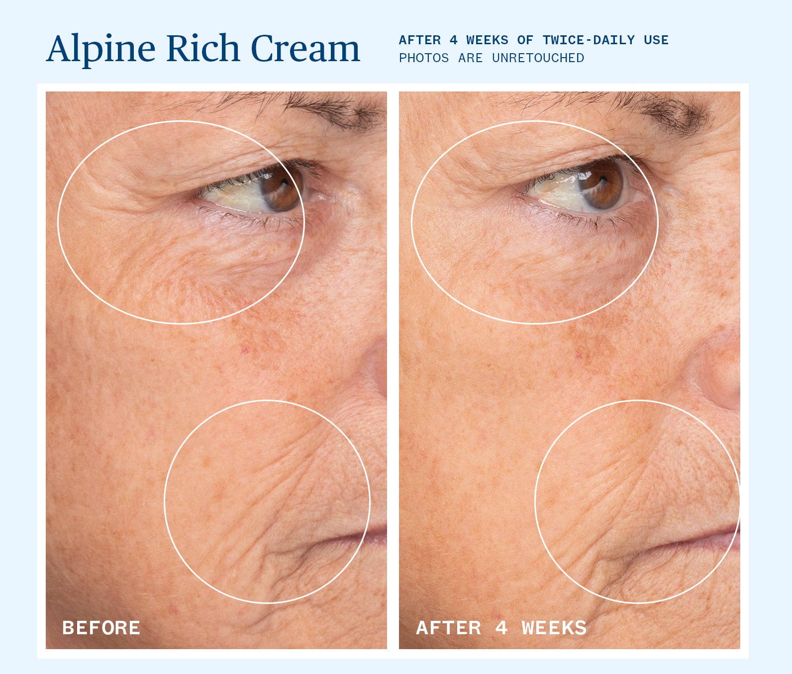 Alpine Rich Cream - Premium Moisturizing Face Cream for Dry & Sensitive Skin | Hydrating & Nourishing Skincare for Day & Night Use