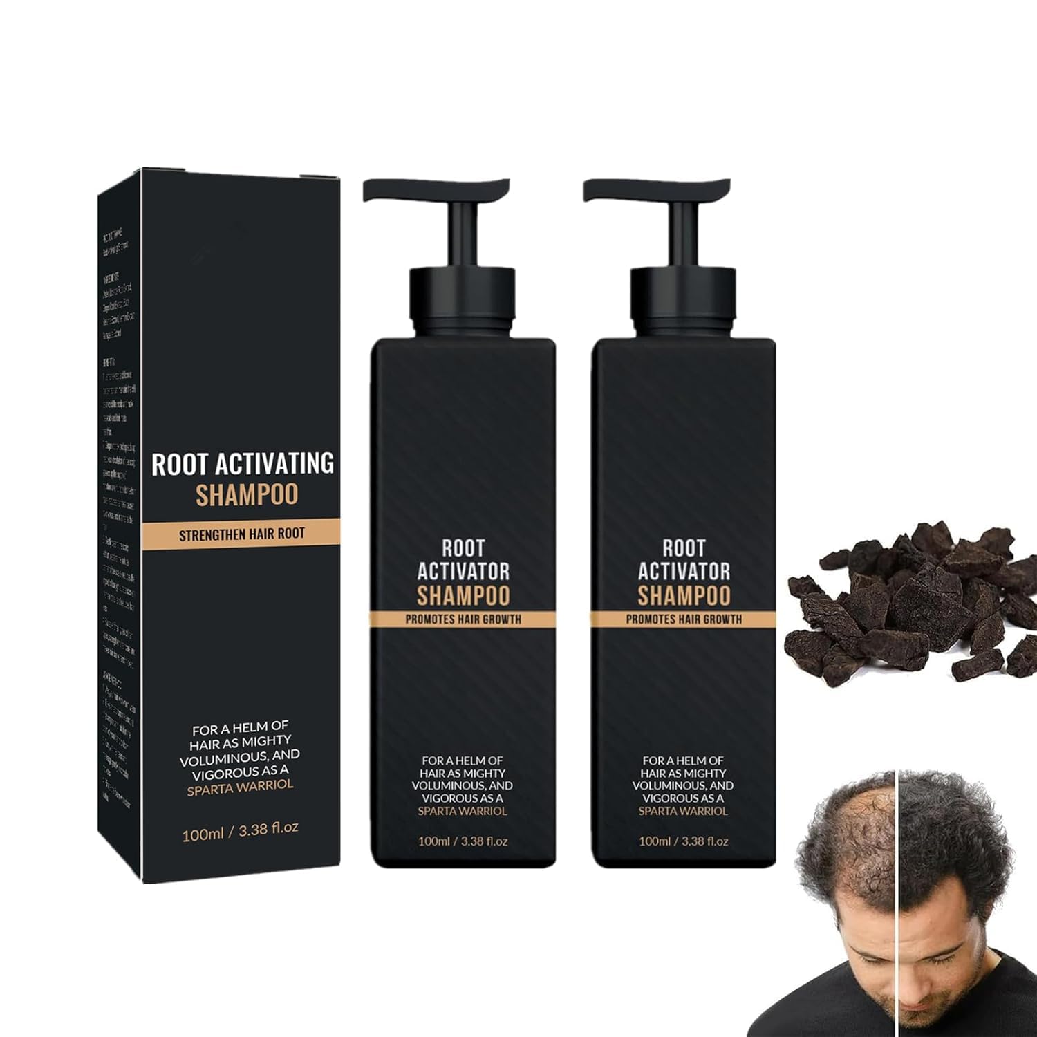 Spartan Root Activator Shampoo for Hair Regrowth - Natural Shampoo for Men & Women - 2 x 100ml Bottles - Promotes Thicker Hair & Reduces Hair Loss - Perfect for Daily Use & Scalp Care