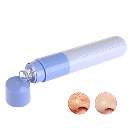 Rexmon Mini Electric Portable Facial Pore Cleanser - Blackhead & Dirt Remover Vacuum for Deep Skin Cleaning | Perfect for Travel, Home & Daily Skincare Routine