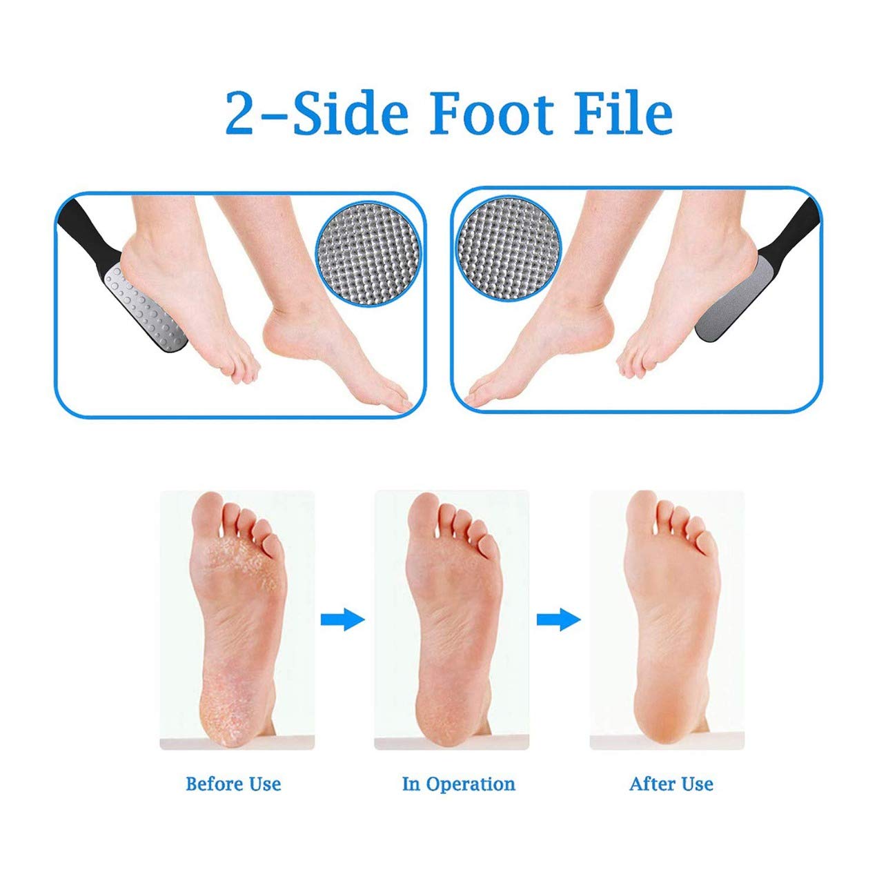 SIYAA Double Sided Metal Foot File - Callus Remover & Dead Skin Scrubber for Soft Feet - Professional Pedicure Tool for Home Spa & Salon Use - Pack of 1