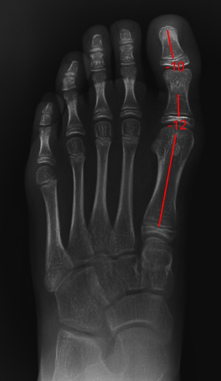 Refurbished A2D2 Digital X-ray System with Xcel X-ray - High-Quality Medical Imaging for Dental Clinics & Hospitals
