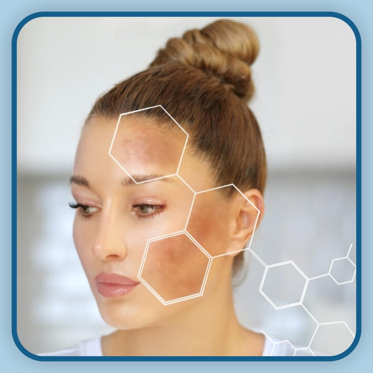 Melaklen Cream - Intense Moisturizing & Brightening Face Cream for Dry, Normal & Sensitive Skin | Helps Even Skin Tone & Gentle Exfoliation | 15g | Perfect for Daily Skincare Routine & Nighttime Hydration