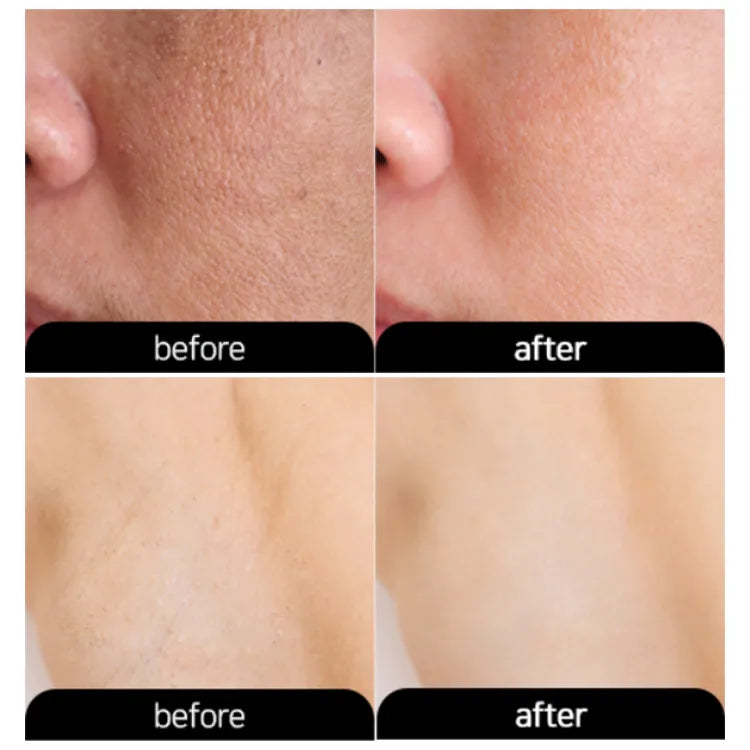 Dr.K Underarm Whitening Cream 3W CLINIC - 100g Dark Spot Corrector for Armpits, Brightening & Smoothing Treatment - Perfect for Daily Use, Post-Wax Care & Summer Skin Prep