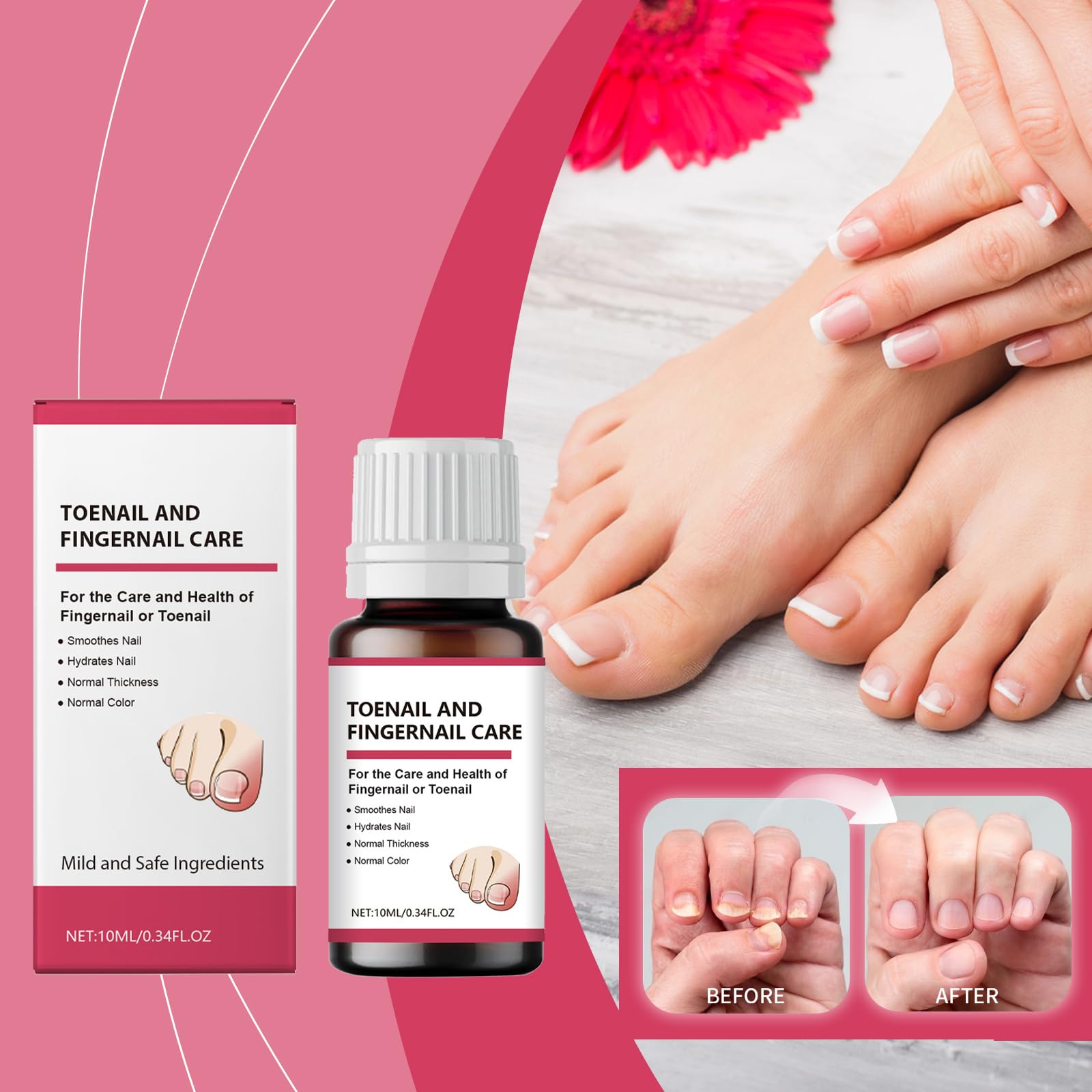 Extra Strength Toenail Fungus Treatment - Natural Ingredients for Fast Relief (2 Bottles) - Effective Solution for Toenail Fungus & Healthy Nail Care at Home