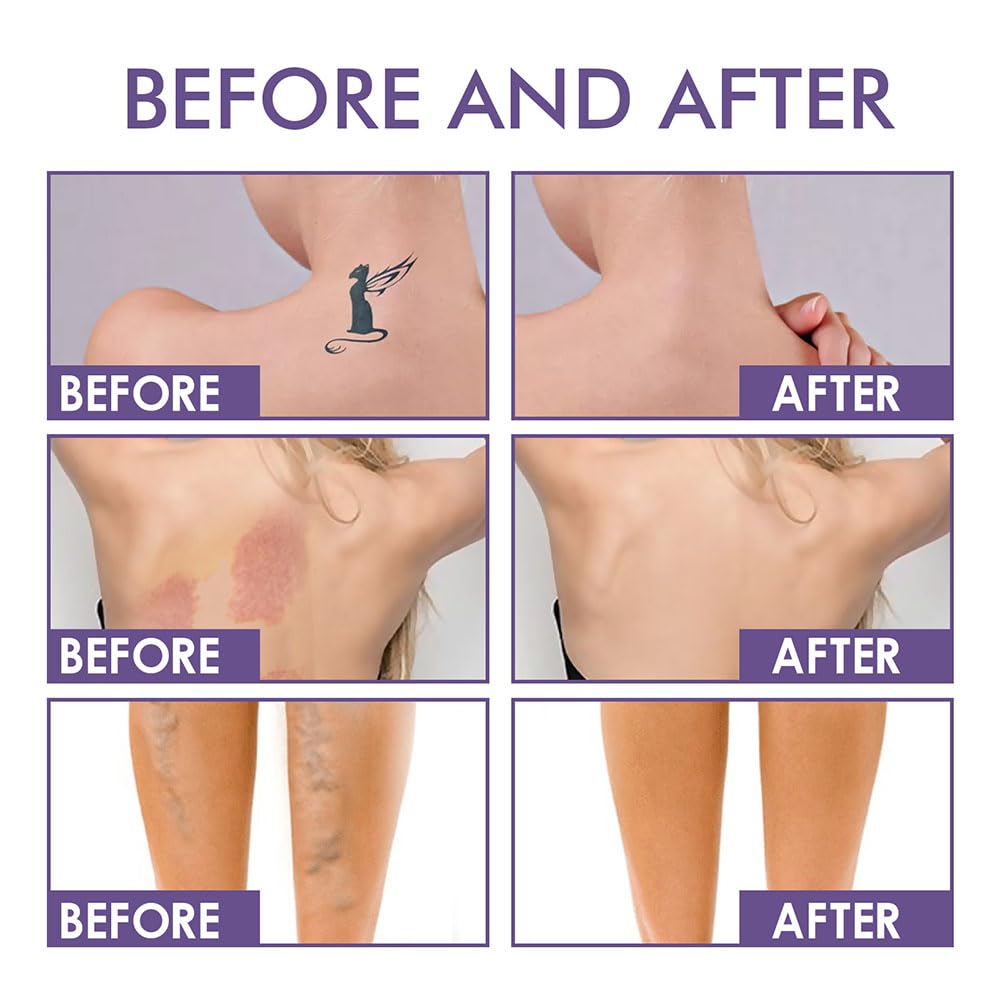 Full Coverage Body Concealer Lotion - Tattoo Cover Up, Scar Concealer, Long Lasting & Waterproof Foundation (1pc) for Flawless Skin at Weddings, Photos & Everyday Wear