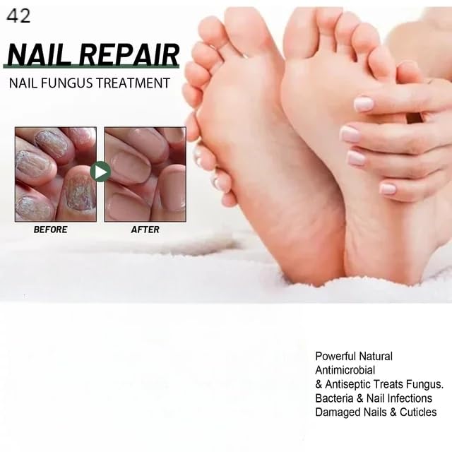 Nail Strengthening Gel Oil - Nourishing & Brightening Treatment for Strong, Smooth, Healthy Nails | Promotes Healthy Nail Growth | Ideal for Nail Fungus Prevention & At-Home Manicures