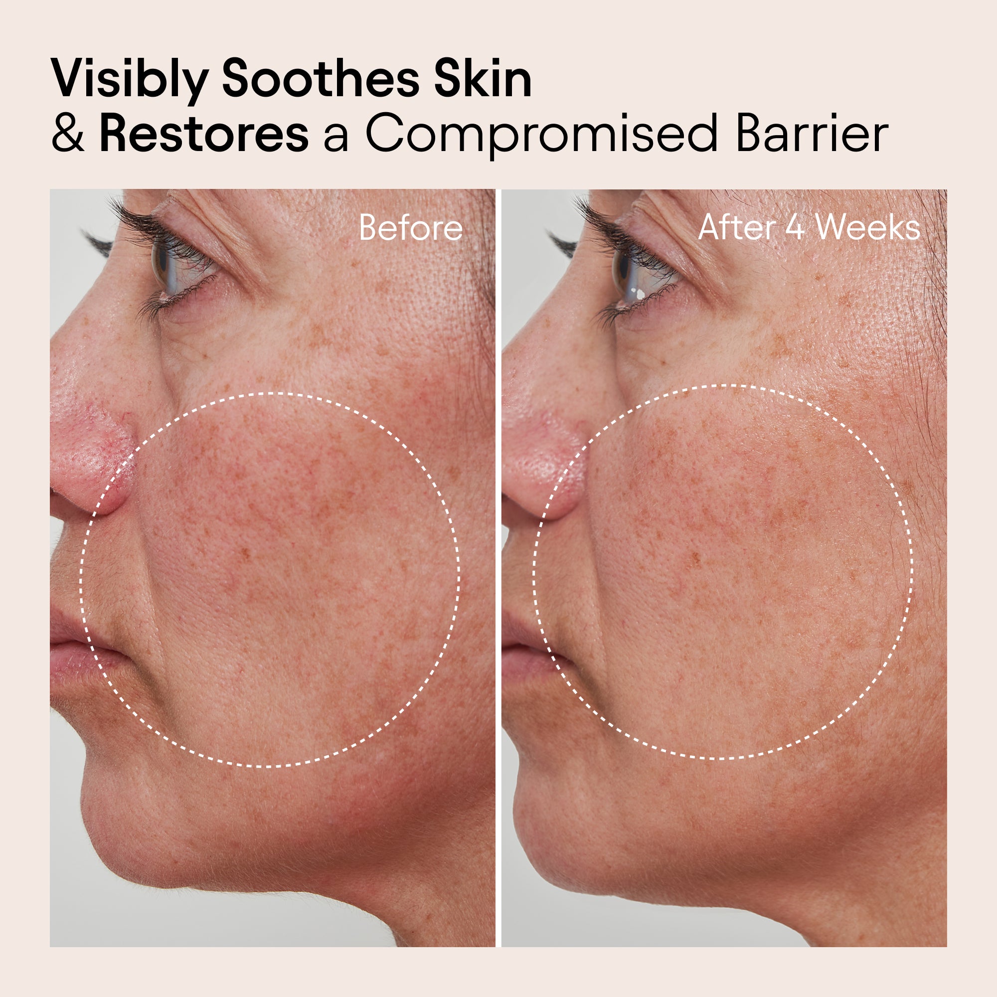 Best Barrier Repair Cream for Dry & Sensitive Skin - Intense Hydration & Moisturizing Face & Body Cream - Ideal for Night Use & Post-Procedure Care