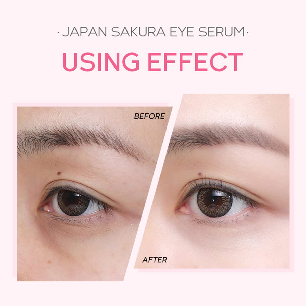 AKARY 2-in-1 Sakura Eye Serum & Massage Roller - Anti-Aging Eye Treatment for Dark Circles, Puffiness & Fine Lines - Under Eye Cream for Bags & Wrinkles - Perfect for Morning Skincare Routine & Nighttime Relaxation