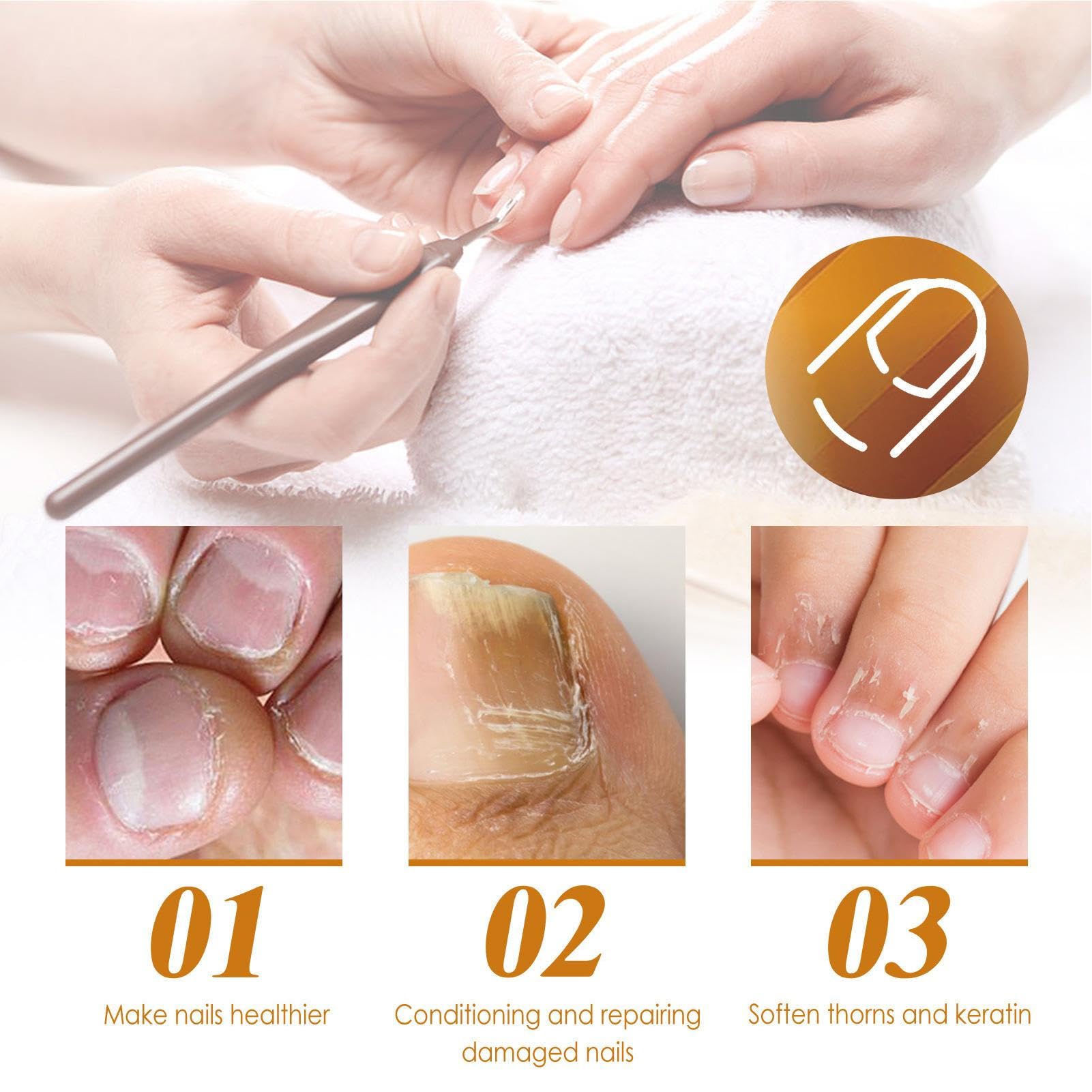 Cuticle Remover Gel - 1oz Instant Nail Strengthening & Exfoliating Treatment | 15-Second Nail Care Solution for Hands & Feet | Perfect for Salon & At-Home Manicures