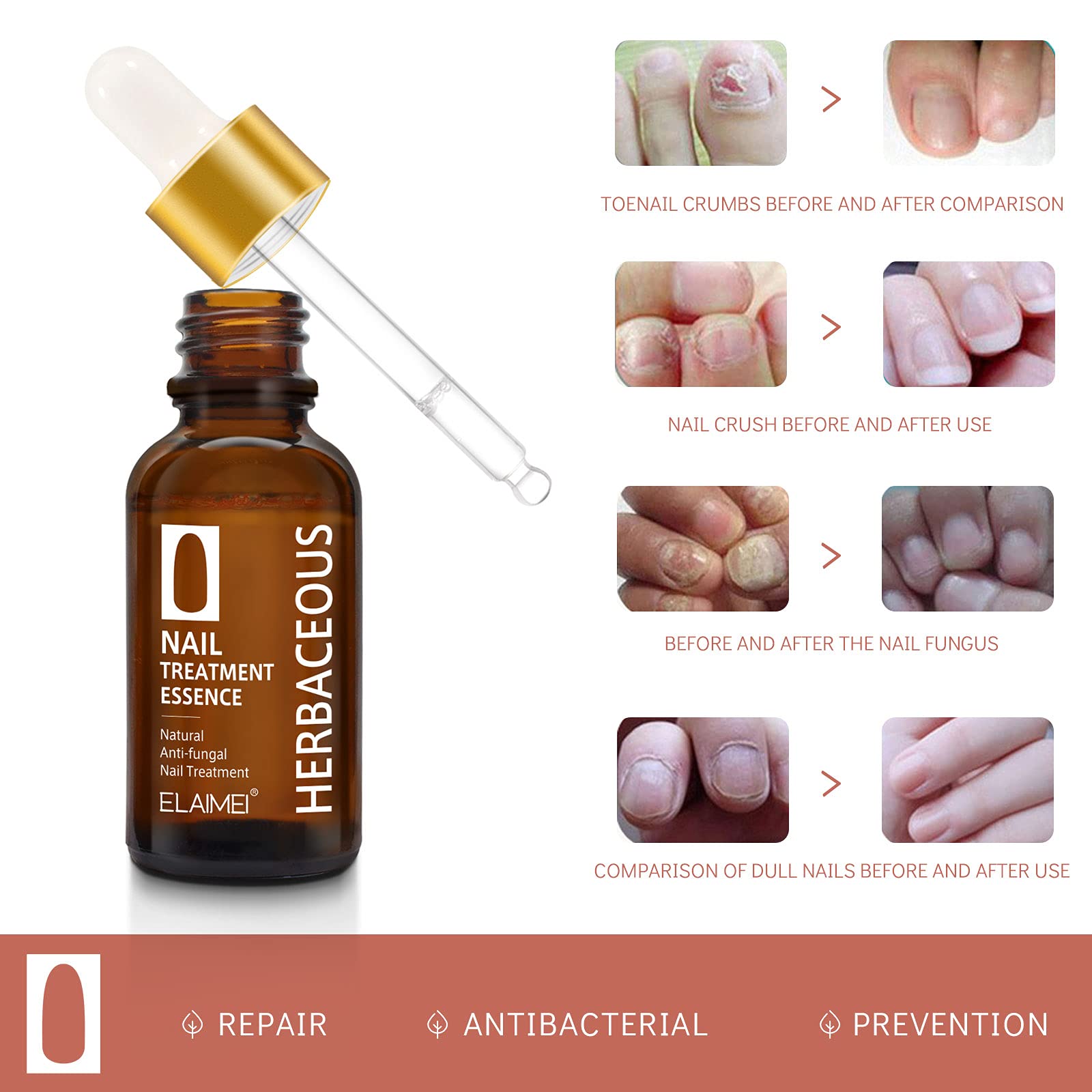 Extra Strong Fungal Nail Treatment for Toenails - Anti-Fungus Solution to Repair & Protect Discolored, Brittle & Cracked Nails - Restores & Rehydrates Damaged Nails (30ML) - Ideal for Athletes, Swimmers & Daily Foot Care