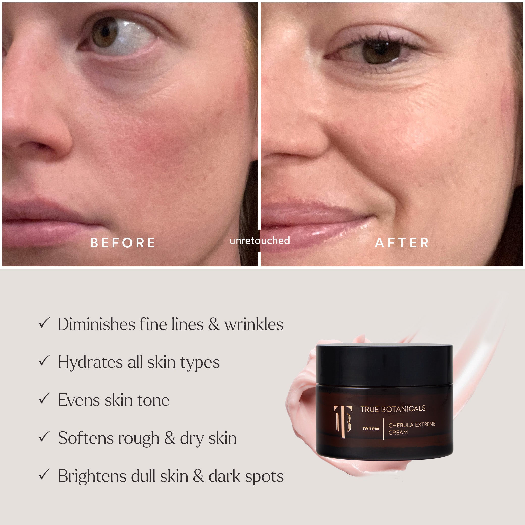 Deep Hydration Renewal 3-Piece Skincare Set - Daily Moisturizing Essentials for Dry Skin | Morning & Night Routine