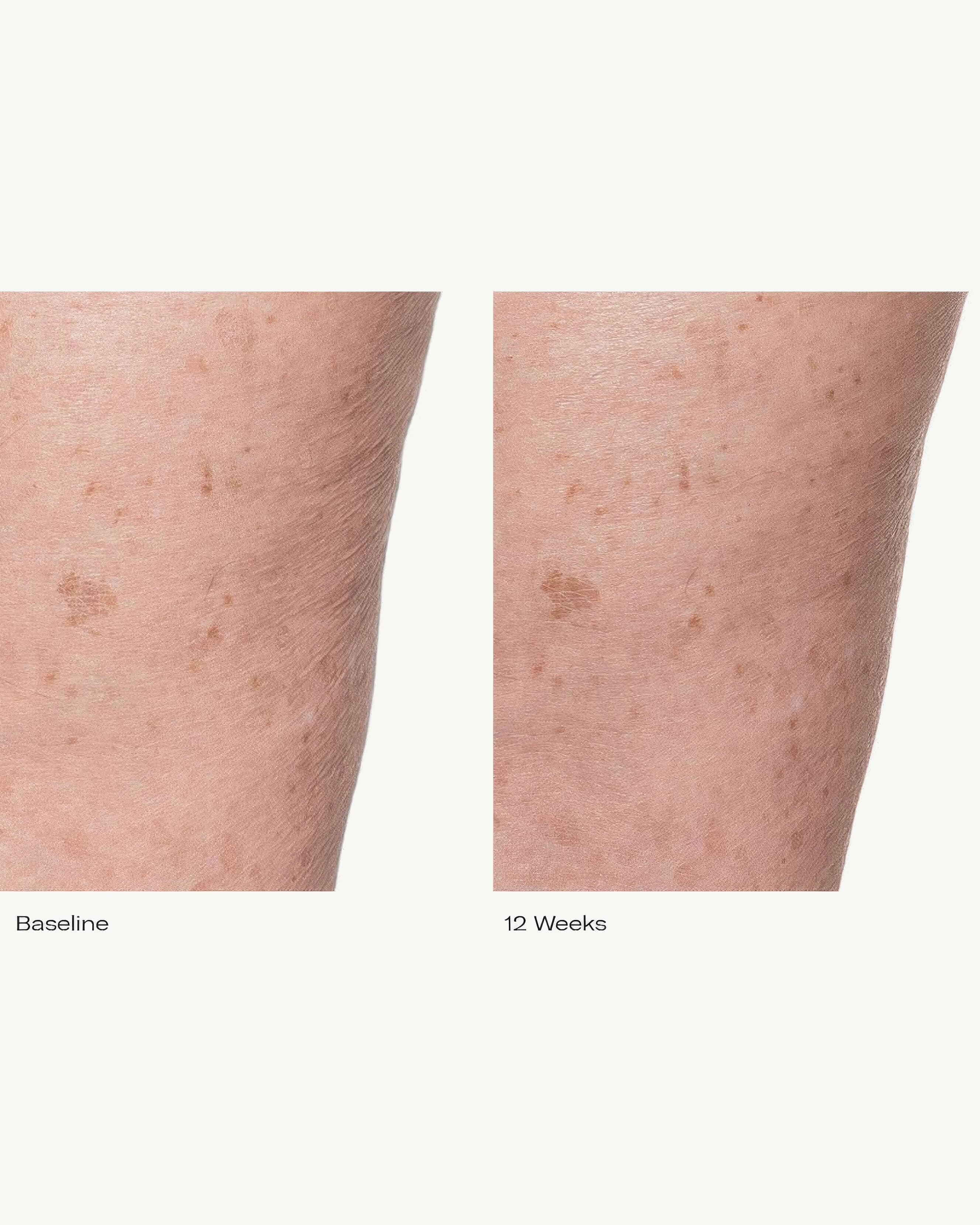 Plumbody™ Hydrating Body Crème - Ultra Moisturizing & Nourishing for Dry Skin | Perfect for Daily Use, After Shower & Nighttime Skincare Routine