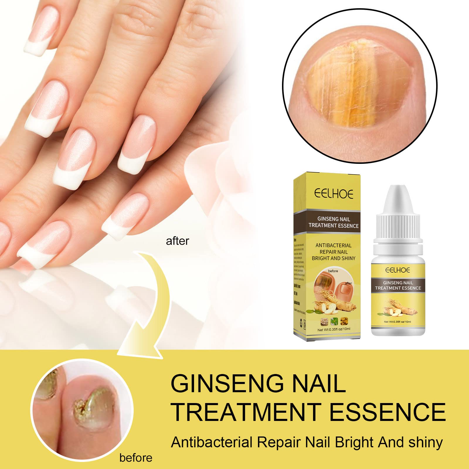 10ml Ginseng Nail Treatment - Herbal Hand & Foot Whitening Cream for Cracked, Rough, Brittle Nails - Natural Nail Care Solution for Toe & Finger Nails - Perfect for Pedicures, Manicures & At-Home Nail Care Routines