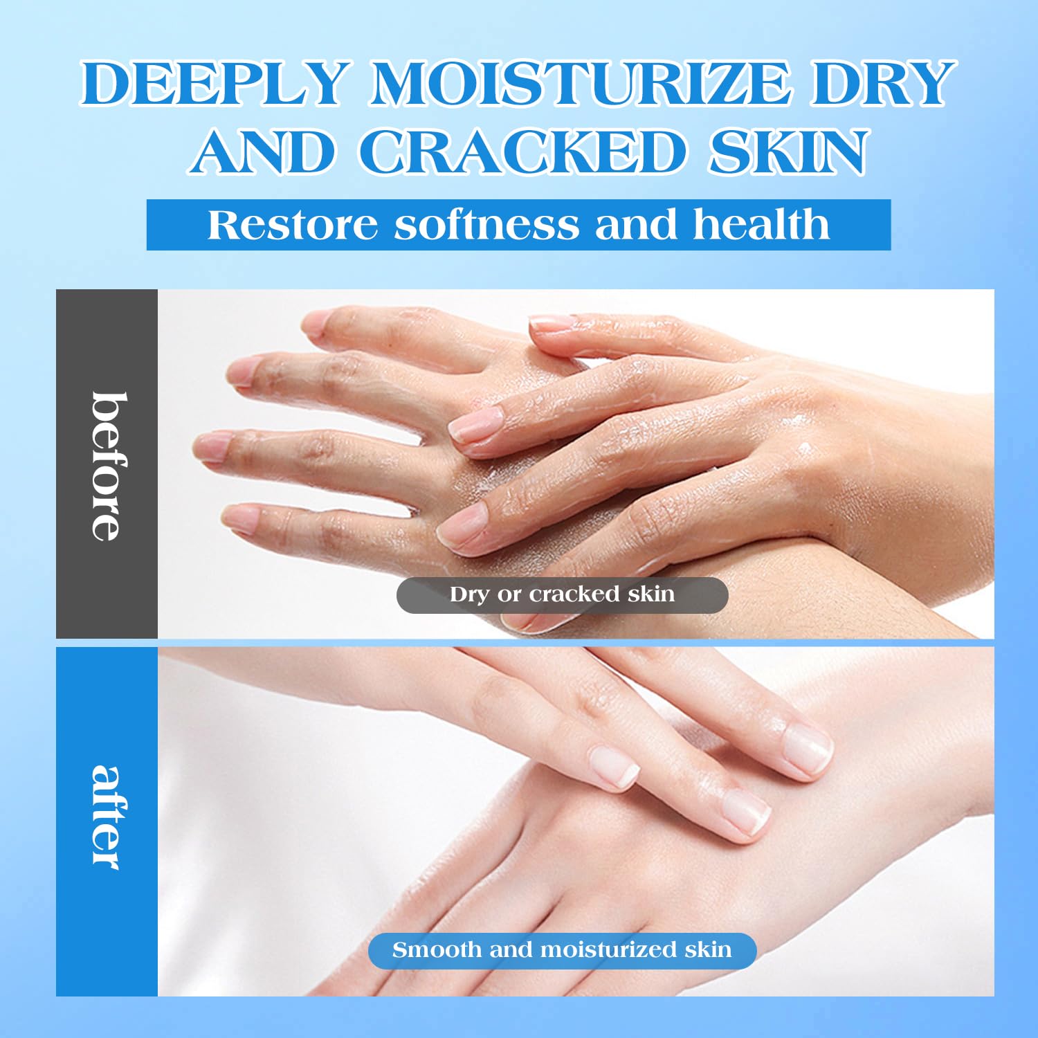 42% Urea Cream for Dry & Cracked Skin - Intense Moisturizing Foot & Hand Repair Cream with 2% Salicylic Acid, 5% Vitamin E, Tea Tree Oil, Aloe Vera & Shea Butter - Maximum Strength Skin Treatment for Calluses, Heel Cracks & Rough Patches - Ideal for Athletes, Diabetics & Dry Skin Care