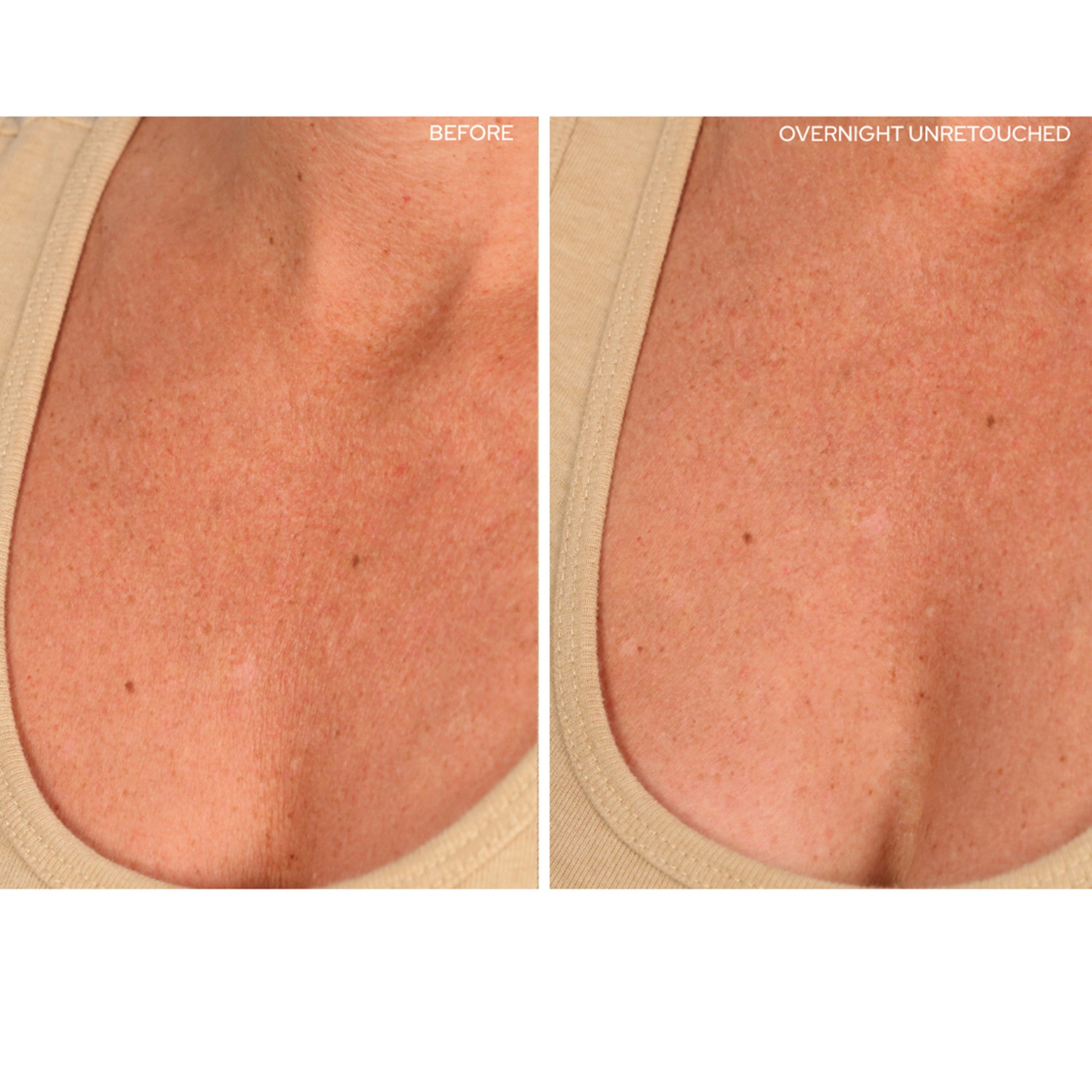 Sio Chestlift - Firming & Lifting Breast Cream for Women | Natural Skin Tightening & Enhancement | Perfect for Post-Pregnancy, Weight Loss & Anti-Aging Care
