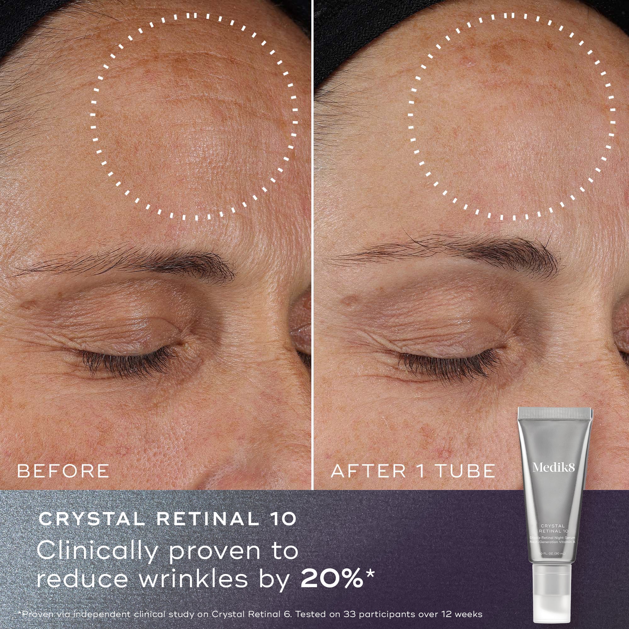 Reduce Wrinkles & Renew Skin with Retinol Cream – Anti-Aging Face Moisturizer for Day & Night Use
