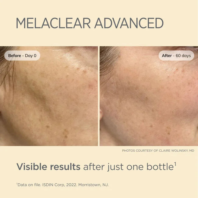 ISDINCEUTICS Melaclear Advanced Skin Brightening Serum - Dark Spot Corrector & Hyperpigmentation Treatment for Face - Perfect for Nighttime Skincare Routine