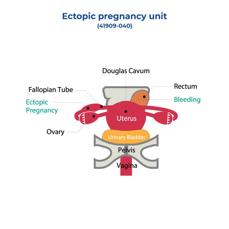 Early Pregnancy Test Kit for Ectopic Pregnancy Detection - Accurate Home HCG Urine Test Strips for Women | Fertility Tracking, Emergency Pregnancy Monitoring & OBGYN Recommended
