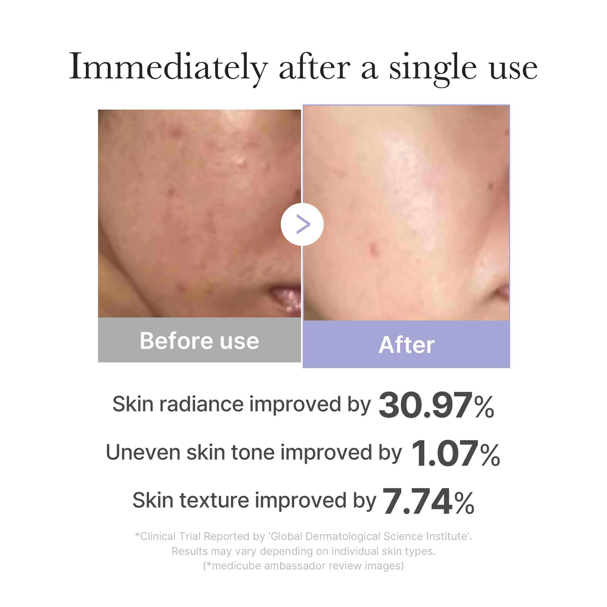 Medicube Calm & Clear Skin Duo Set - Mini Booster Pro Pink & Salmon DNA PDRN Pink Peptide Serum for Acne-Prone Skin | Korean Skincare Routine for Sensitive Skin | Perfect for Daily Hydration & Redness Relief