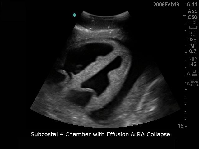 FAST Exam Real Time Ultrasound Training Model - Transthoracic Only for Emergency Medicine & Trauma Assessment Practice (Medical Simulation, Sonography Education, TTE Training)