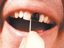 Natural Dental Tooth Wax for Braces & Dentures - Brown & Black - Pain Relief & Comfort for Orthodontic Care & Oral Protection