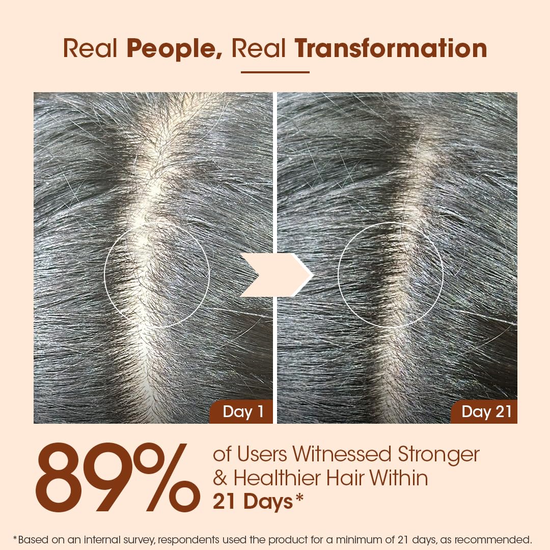 T.A.C Bhringabali Hair Oil - Natural Nourishing Hair Growth Treatment for Men & Women | Stops Hair Loss & Promotes Regrowth | 100ml | Perfect for Daily Scalp Massage & Overnight Hair Care