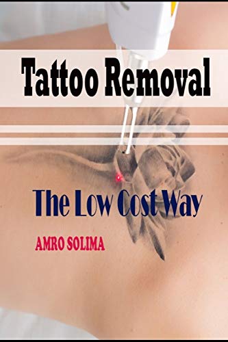 Affordable Tattoo Removal Cream - Safe & Effective Tattoo Fading Solution for At-Home Use | Perfect for Cover-Ups or Pre-Laser Treatments