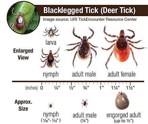 eTradewinds Tick Remover Tool Set - 2 Pack Stainless Steel Tick Removal Device with Leather Case | Safe & Hygienic Pet Tick Tweezers for Dogs, Cats | Perfect for Hiking, Camping & Outdoor Adventures