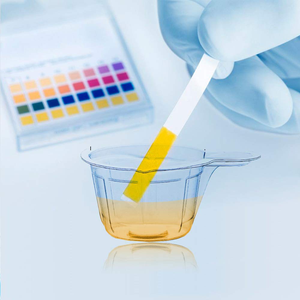 40ml Disposable Plastic Urine Specimen Cups - 80 Pack for Pregnancy Test, Ovulation Test & pH Test | Easy-to-Use Medical Sample Collection Containers | Home Testing, Clinic & Laboratory Use