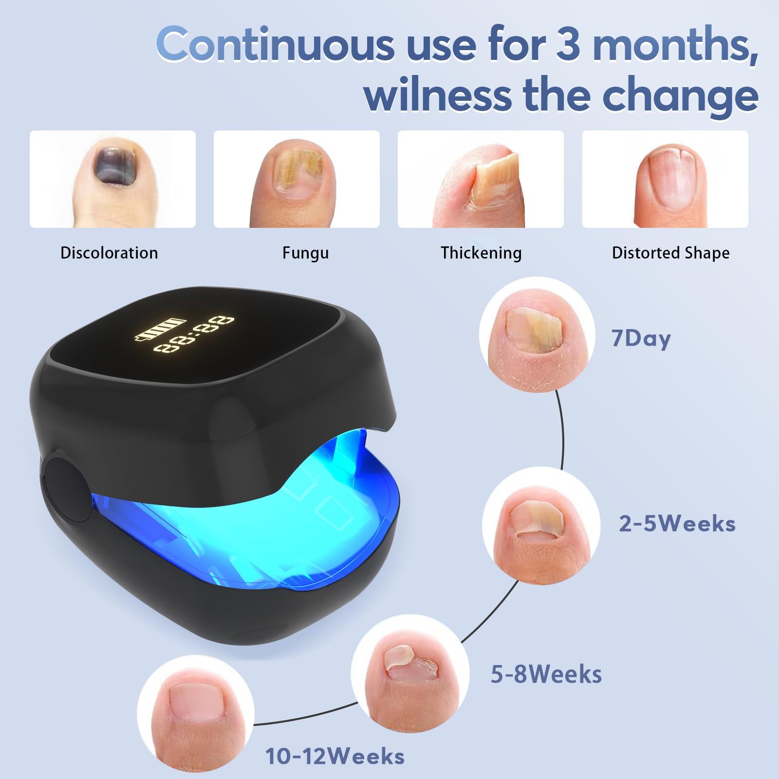 Best Nail Fungus Laser Treatment Device - LED Light Therapy for Toenail & Fingernail Fungal Infections | Improves Nail Health, Reduces Deformation & Pain | Portable Home Use for Athletes, Seniors & Diabetics (Black)