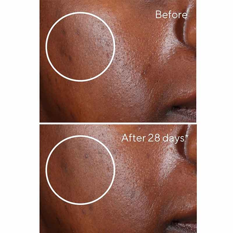 Murad Environmental Shield Rapid Dark Spot Correcting Serum - Brightening Face Treatment for Hyperpigmentation & Age Spots - Perfect for Daily Skincare Routine & Nighttime Use