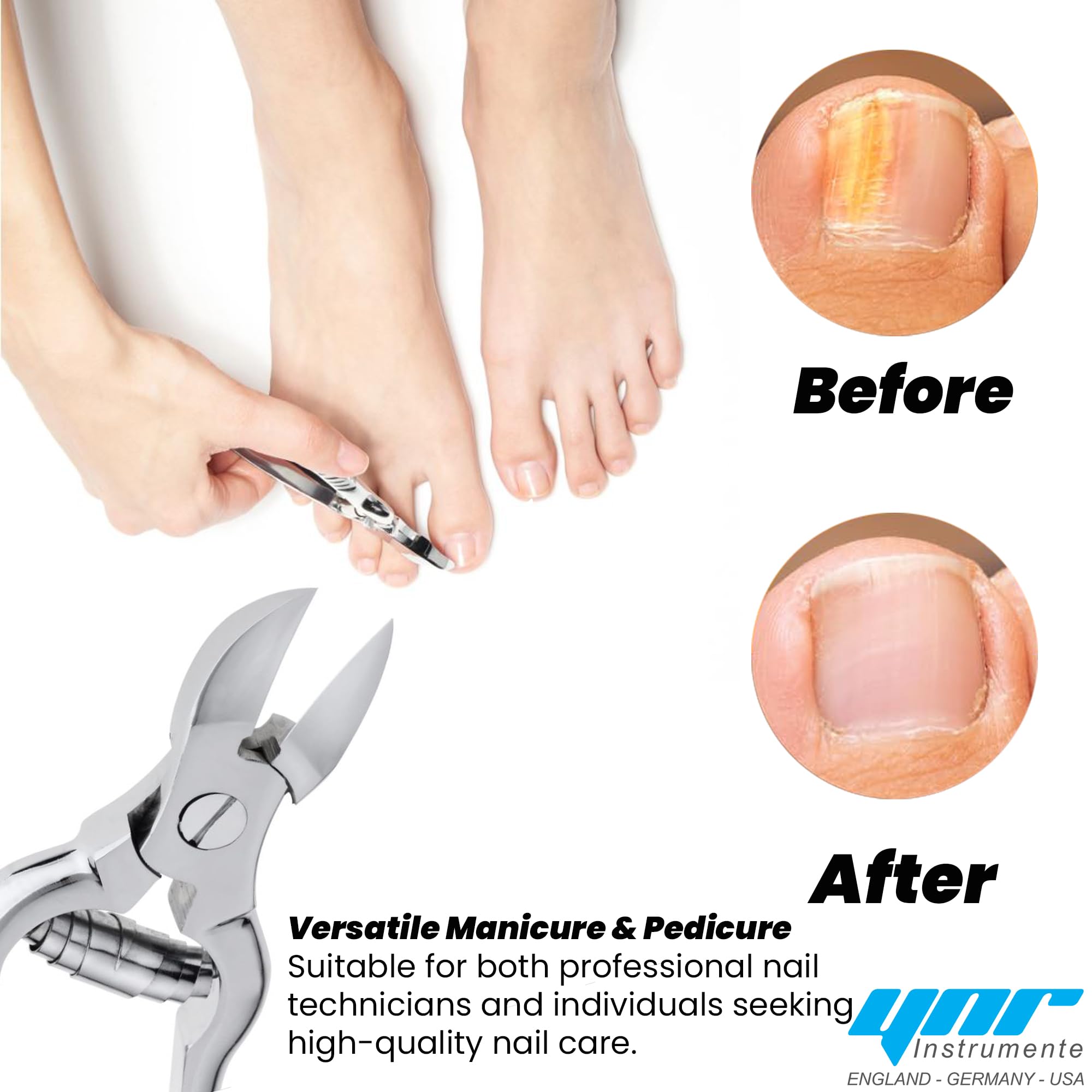 Professional Heavy Duty Toe Nail Clippers for Thick Nails - Chiropody & Podiatry Grade Stainless Steel Nippers - Perfect for Elderly, Diabetic Foot Care & Ingrown Toenail Treatment