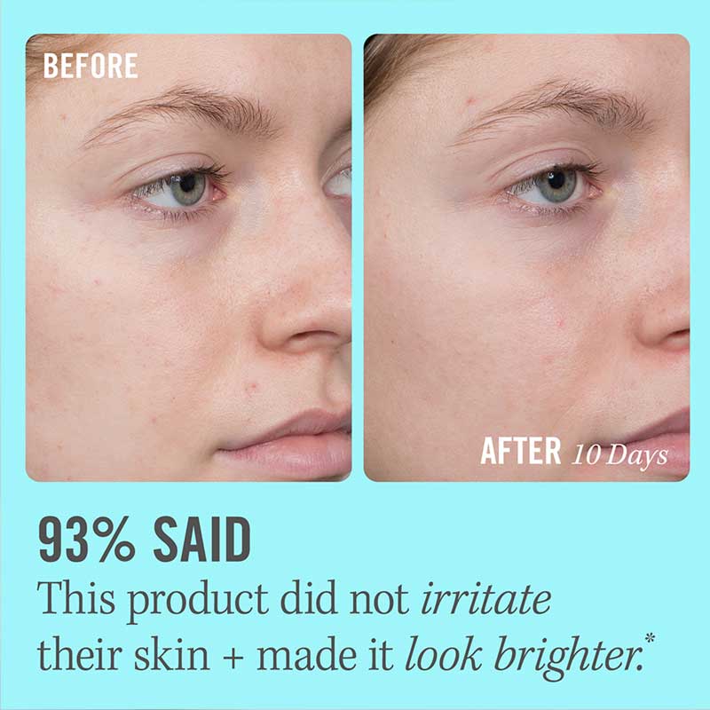 First Aid Beauty 10% Vitamin C Brightening Serum for Face - Dark Spot Corrector & Skin Tone Even Serum - Glow Boosting Treatment for Morning & Night Skincare Routine